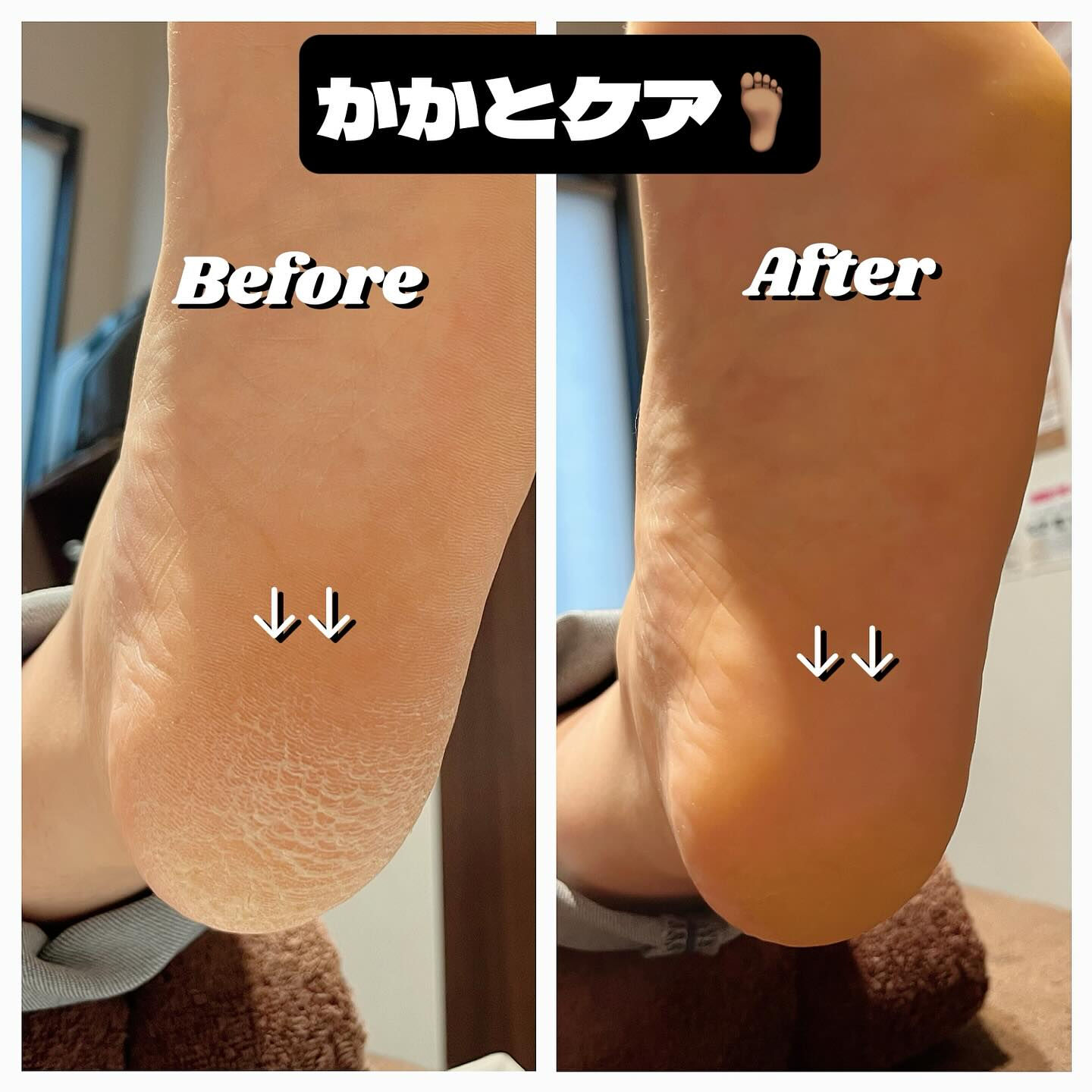 冬の季節が近づくと、乾燥が気になる方も多いはずですね❄️🍂