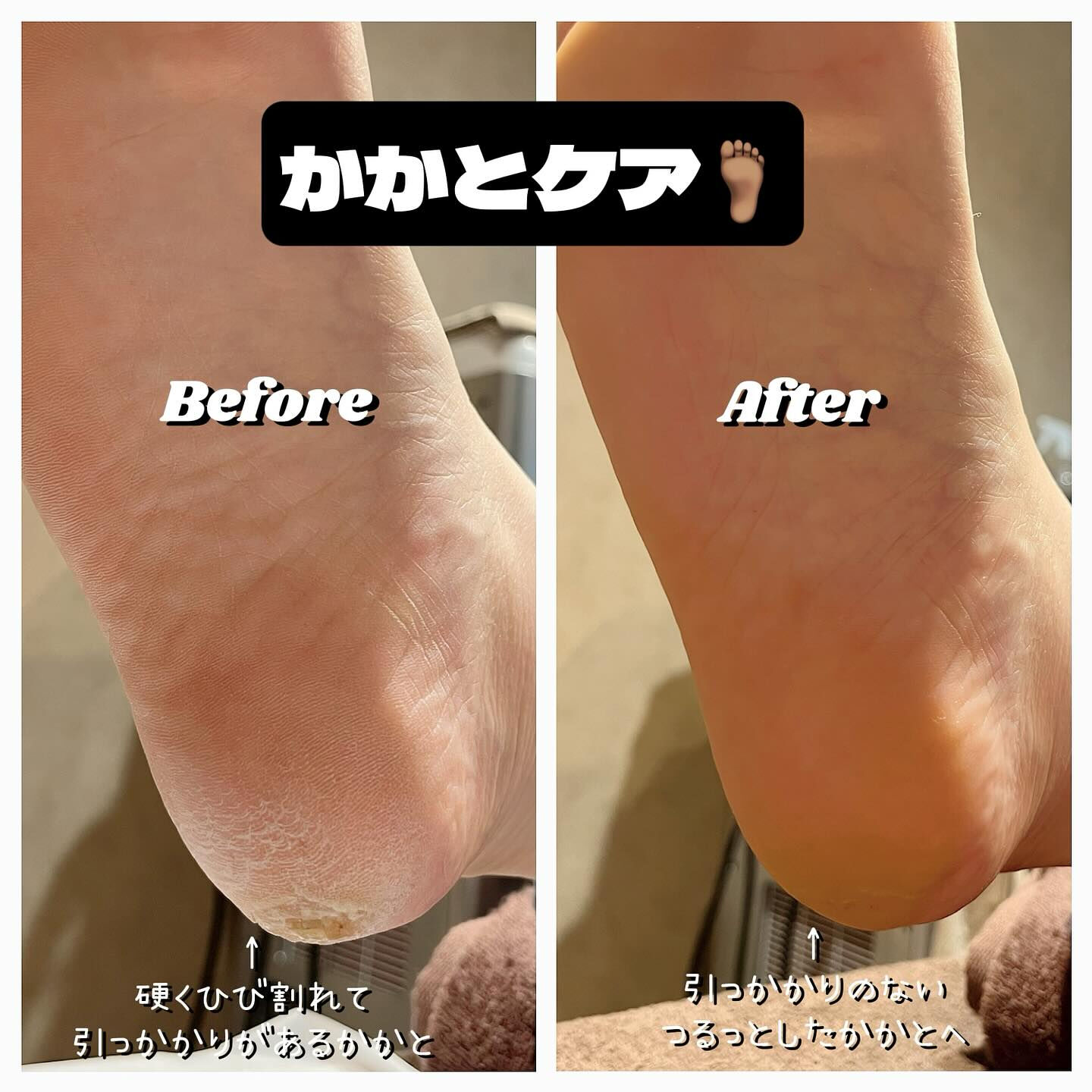 冬の季節が近づくと、乾燥が気になる方も多いはずですね❄️🍂