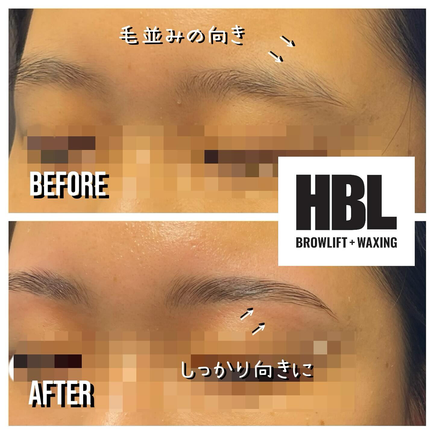 ＨＢＬ（ハリウッドブロウリフト）でお手入れ簡単😎