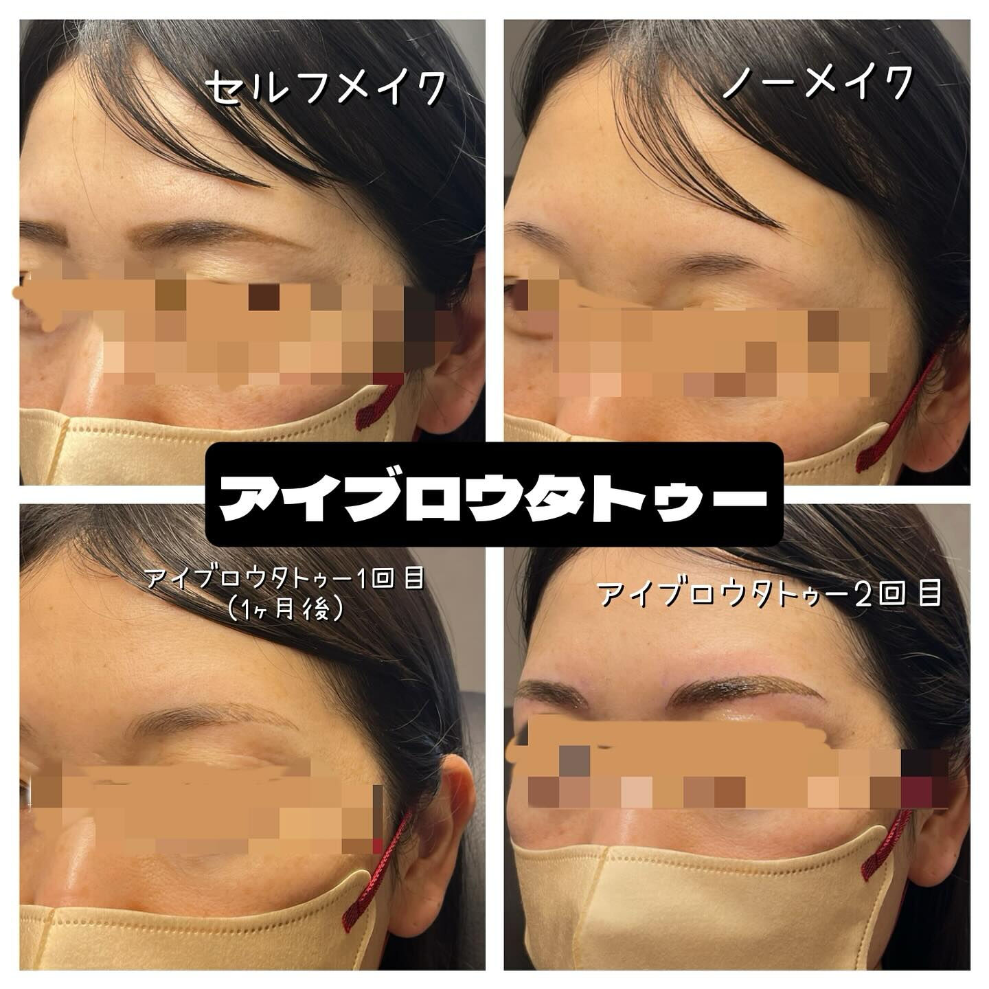 👁️‍🗨️【アイブロウタトゥー】は3回の施術を経て完成し、水