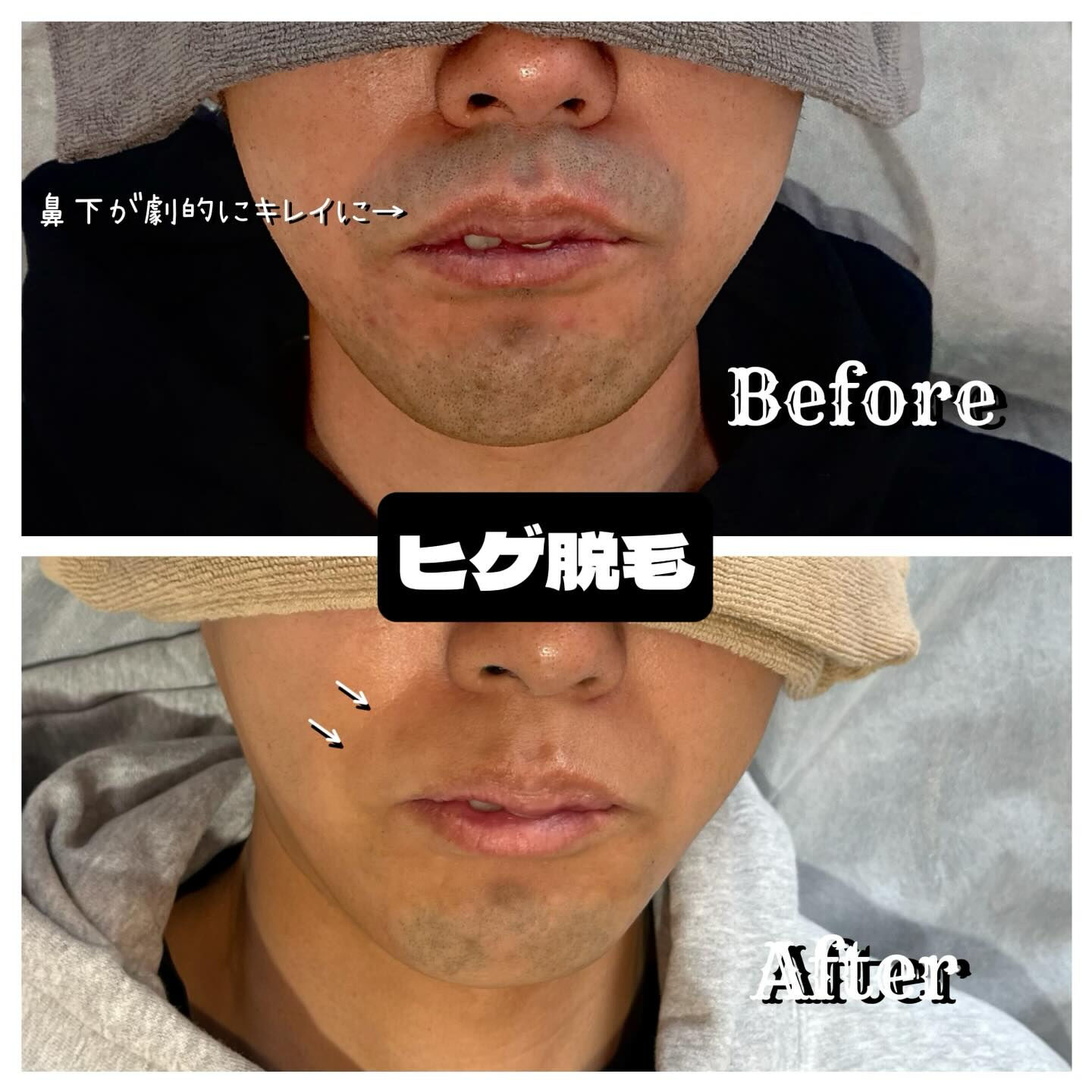 🌟【キャンペーン中】今がチャンス！