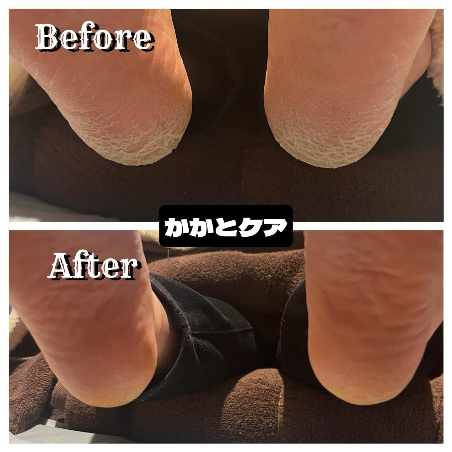 ✨足元から美を追求しませんか？✨