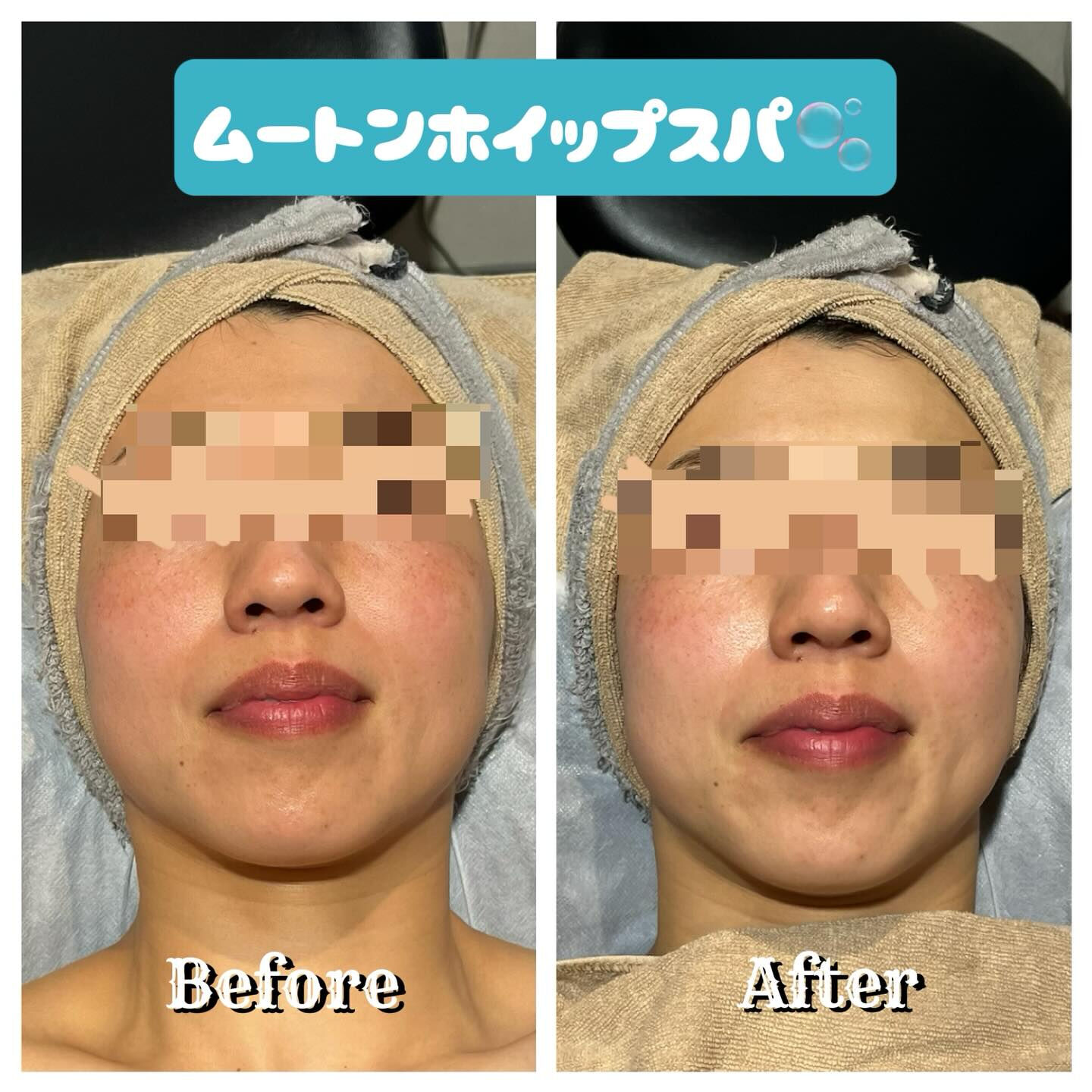 ゆったりとしたひとときを求めるあなたへ、極上の泡洗顔「ムート