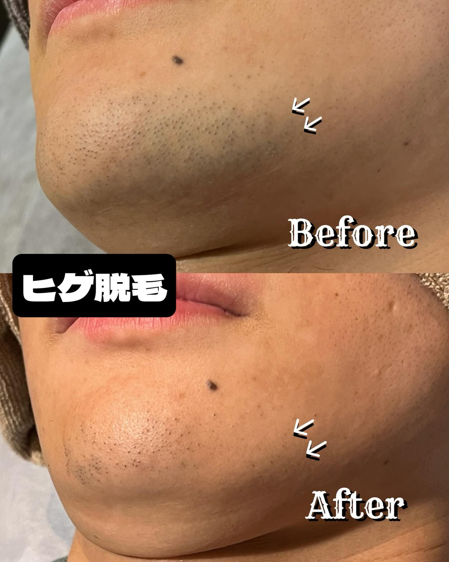 ✨🌞夏に向けての準備はお済みですか？この季節が到来する前に、