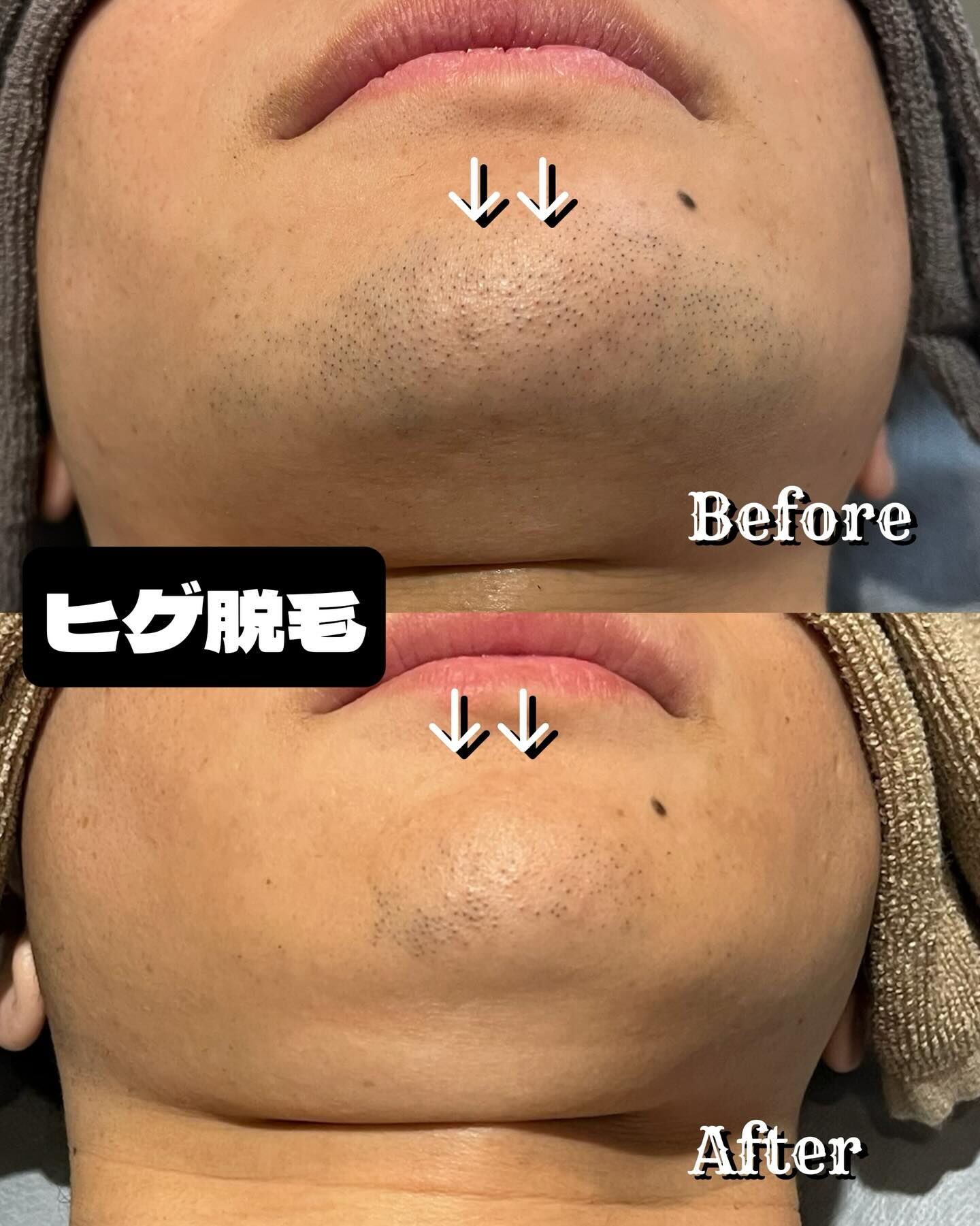 ✨🌞夏に向けての準備はお済みですか？この季節が到来する前に、