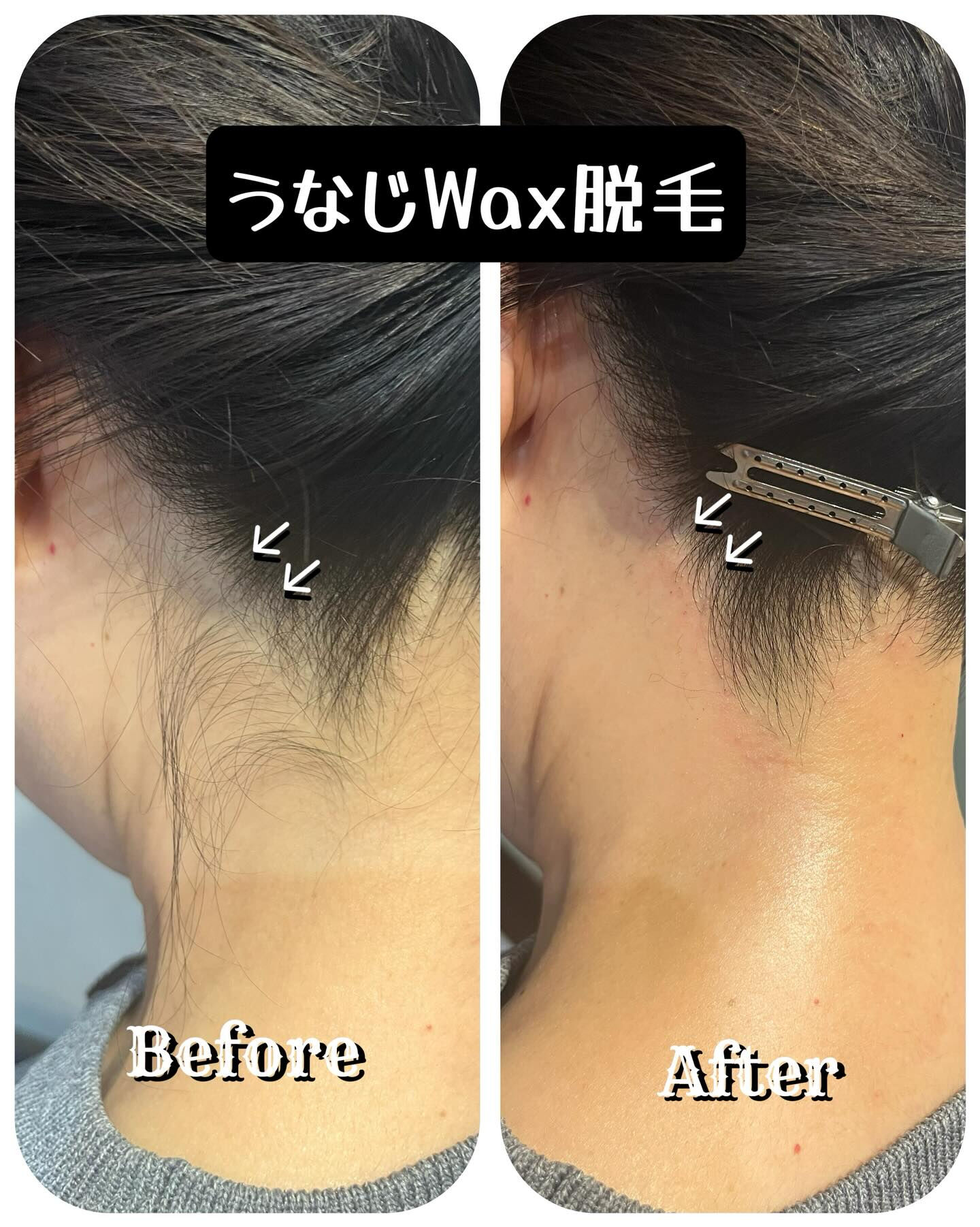 ✨うなじWax脱毛で、すっきり美人度アップしませんか？✨