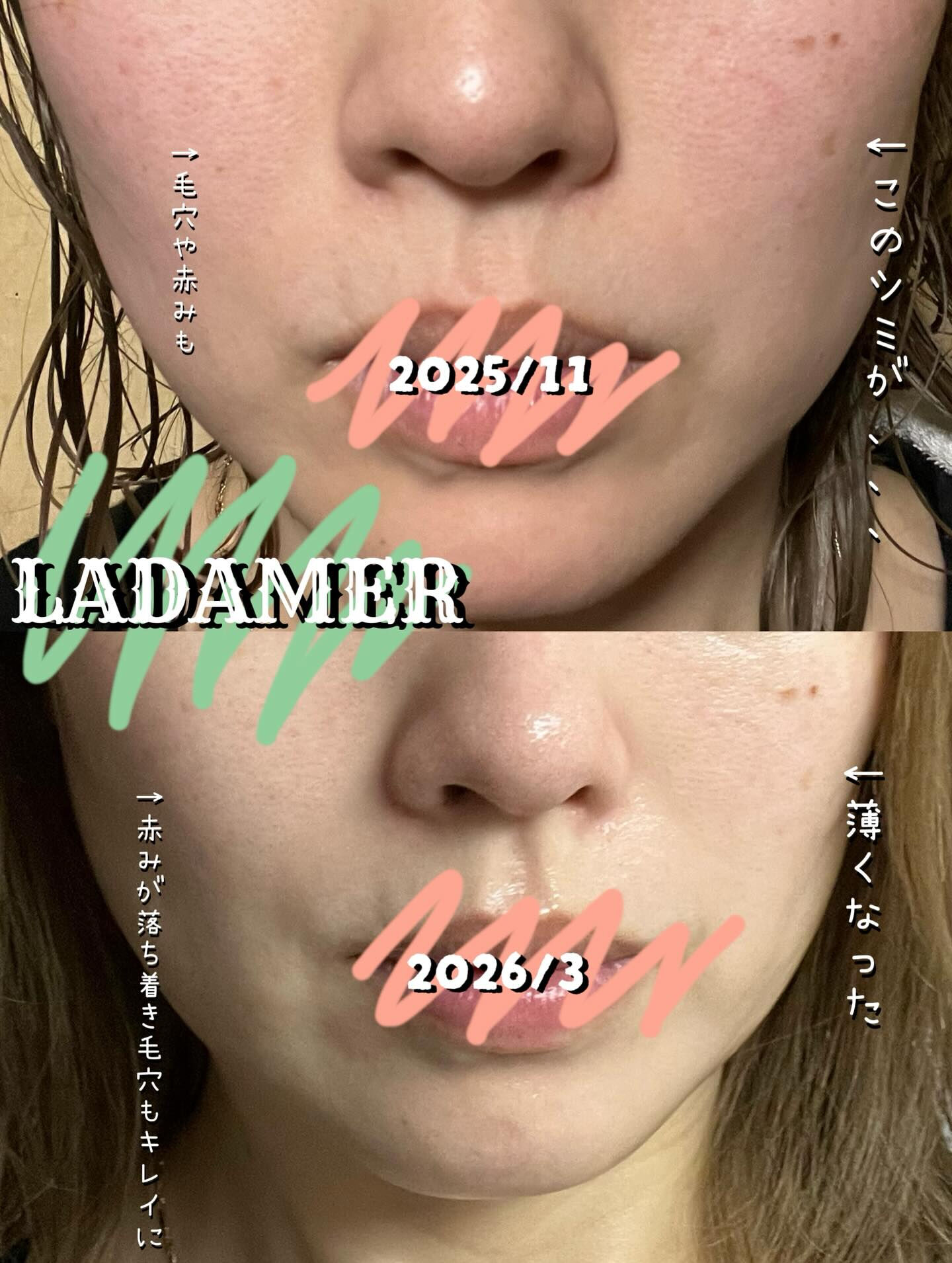 LADAMERを使い始めてから