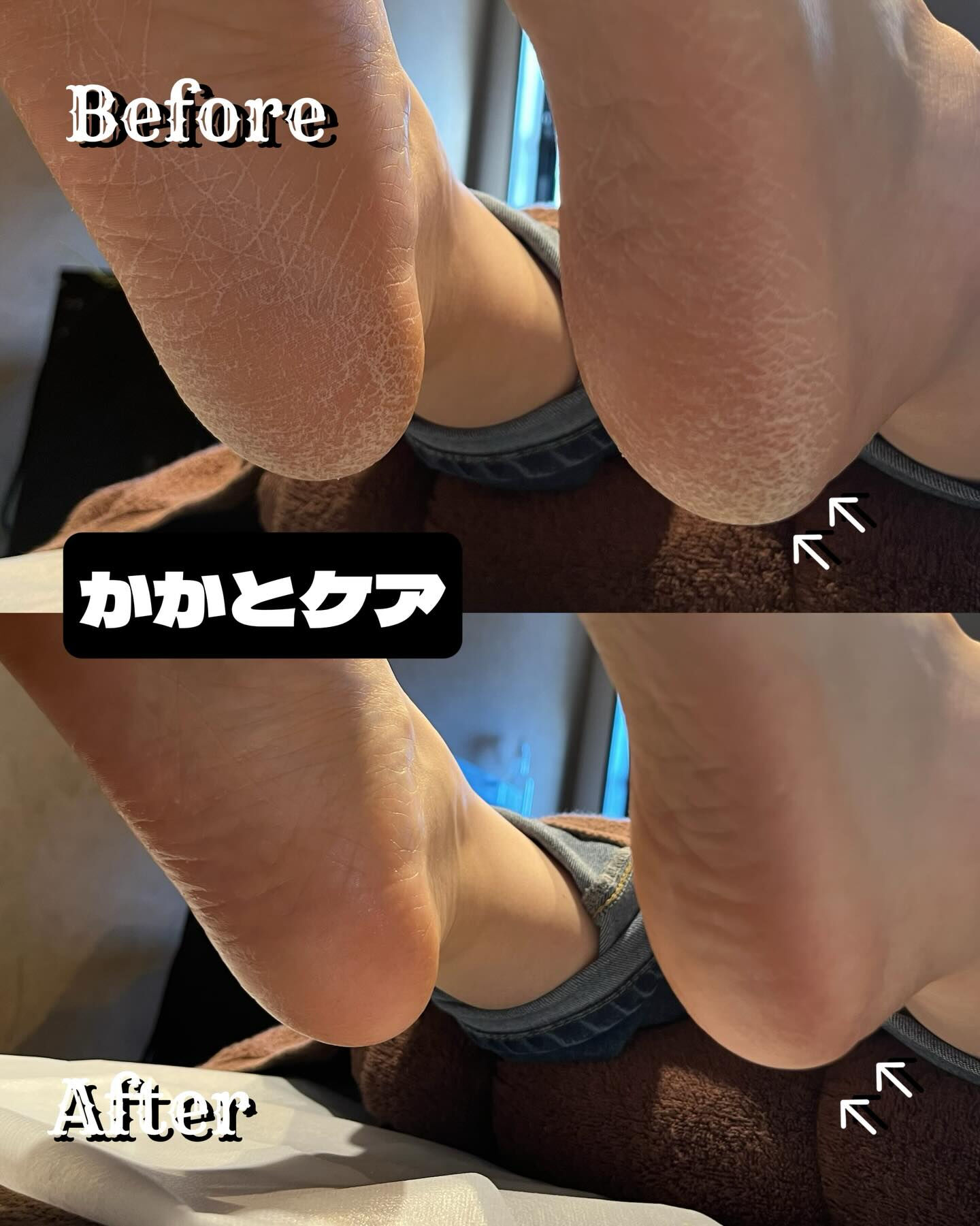 かかとの「かさつき」や「硬さ」が気になっていませんか？