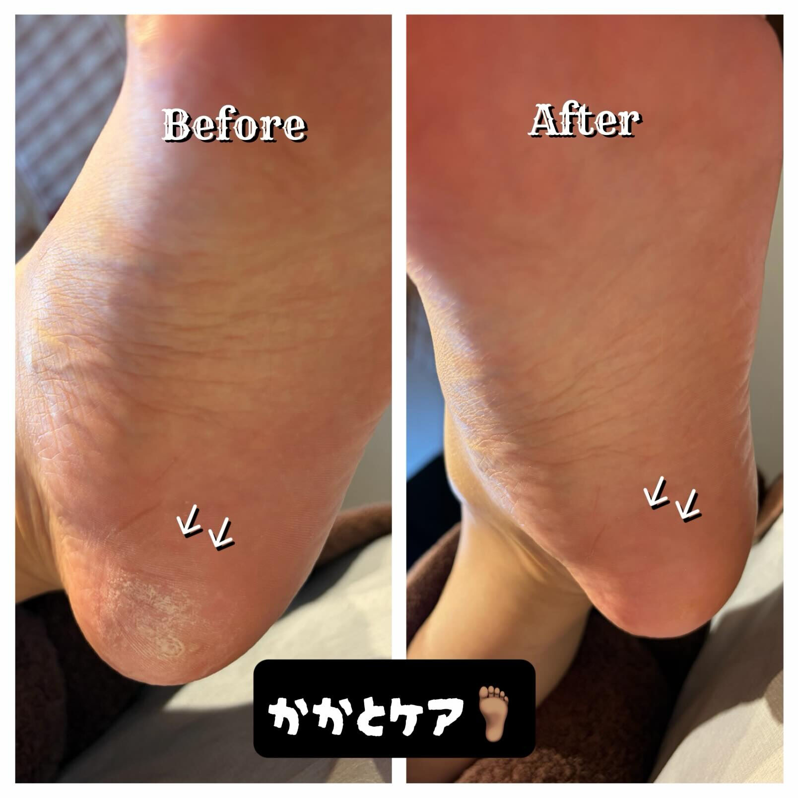 ＼サンダルの季節👡／