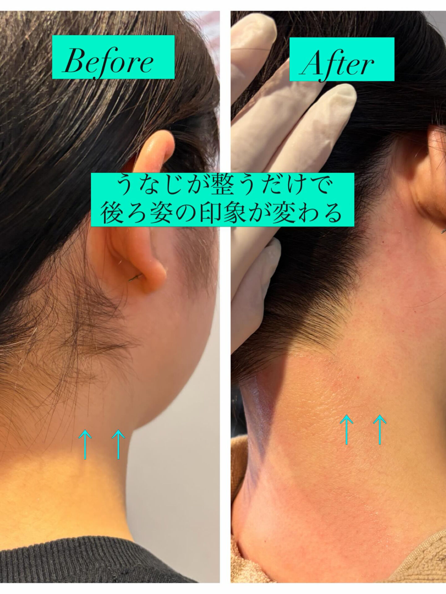 うなじWax初回半額