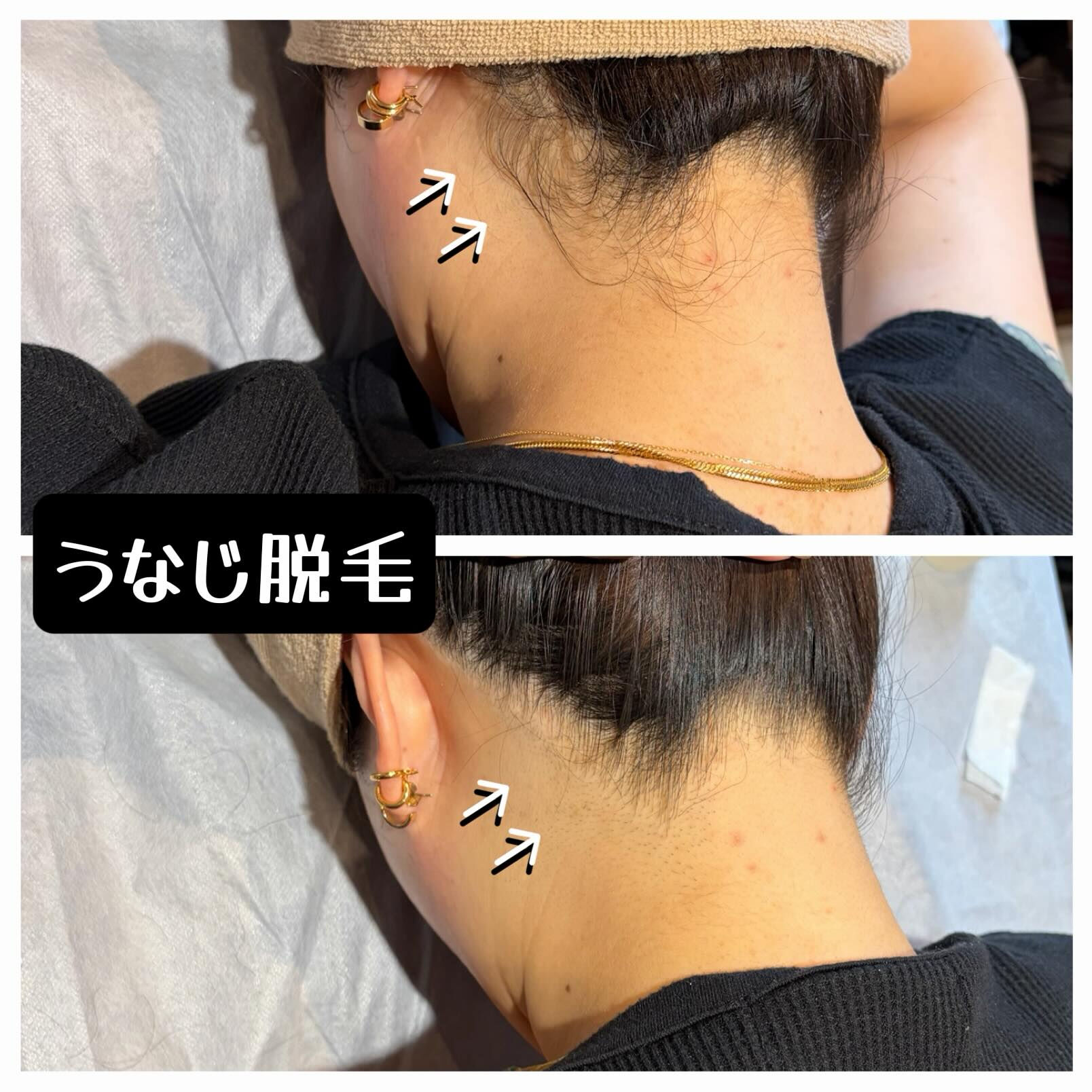 (うなじって、こんなに変わる