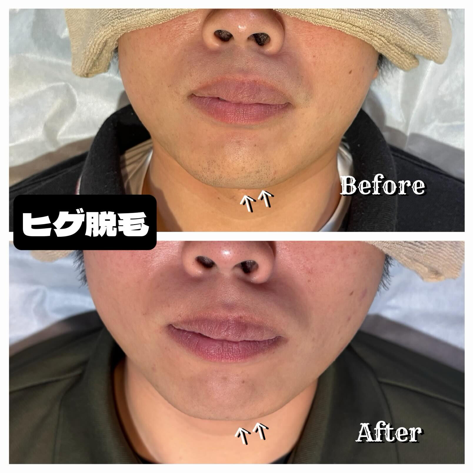 毎朝のヒゲ剃り、当たり前になっていませんか？🪒
