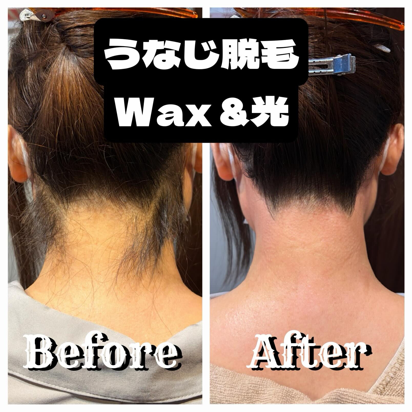 🌊 うなじWax ＋ 光脱毛