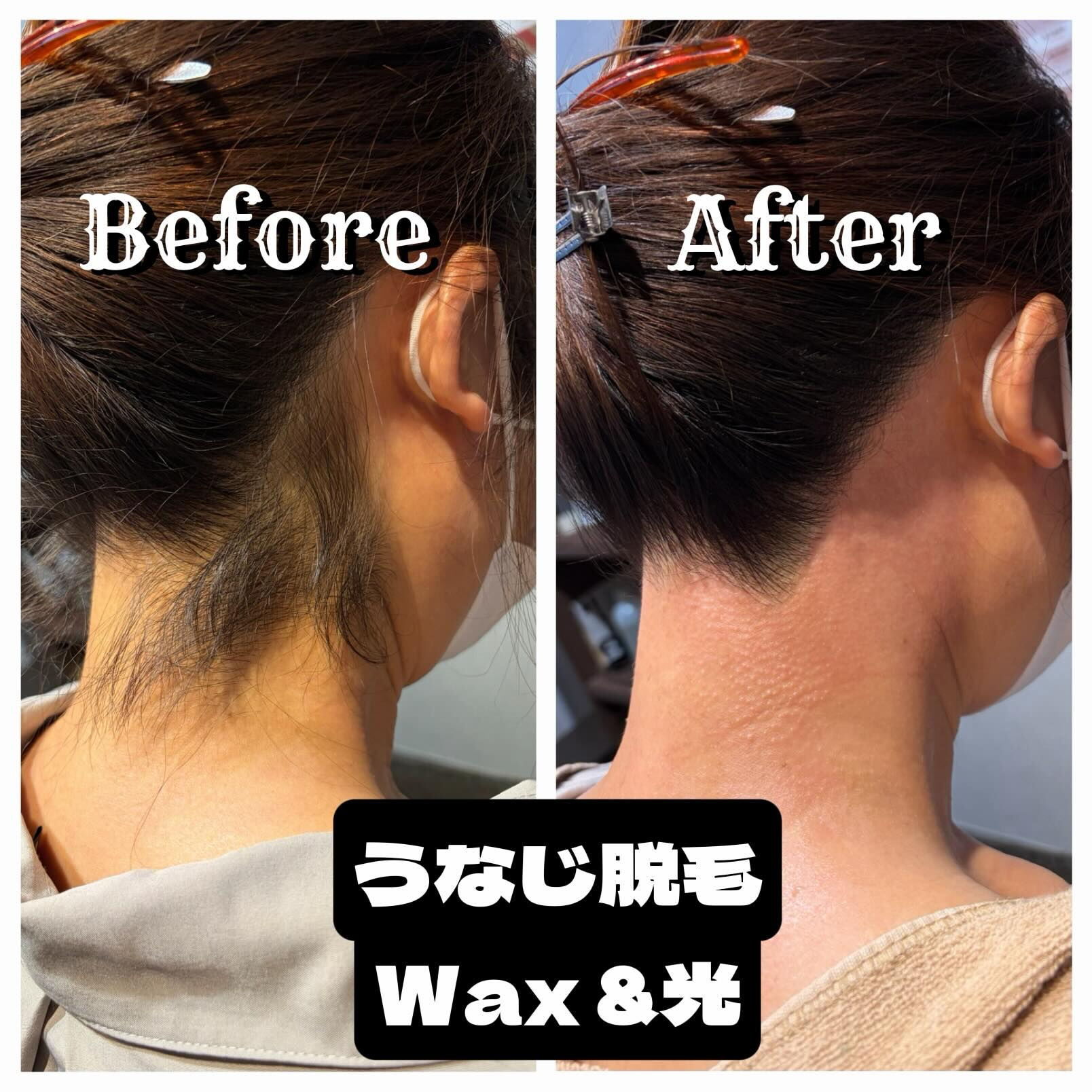 🌊 うなじWax ＋ 光脱毛